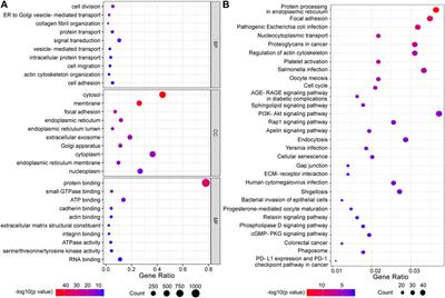 Identification of hexosamine biosynthesis pathway as a novel prognostic signature and its correlation with immune infiltration in bladder cancer